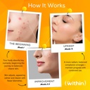 clear-within-clear-skin-vitamin-with-10--6.jpg