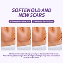 hpufkot-medical-grade-silicone-scar-shee-3.jpg