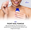 elon-dual-defense-anti-fungal-formula-25-2.jpg
