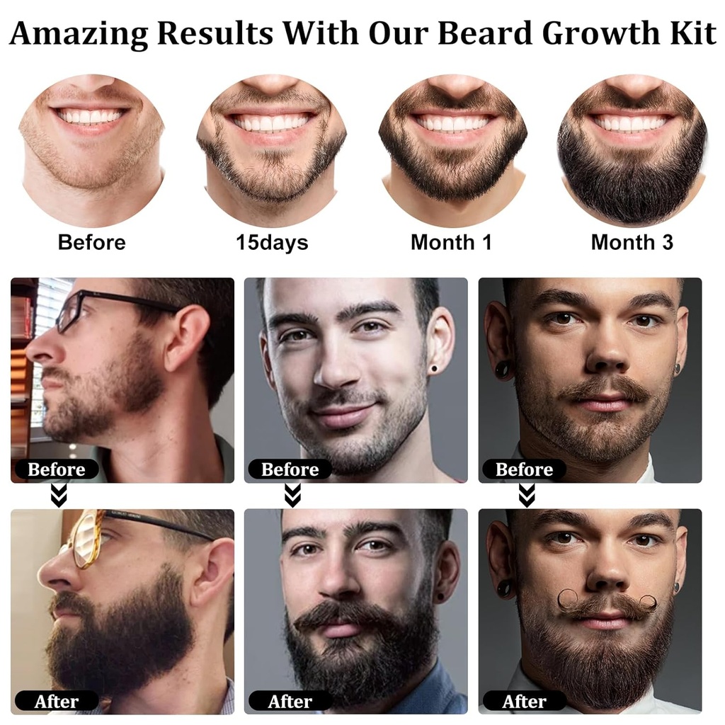 raffin-beard-growth-kit-upgraded-beard-g-6.jpg