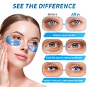 eye-gel-pads-24-pairs---under-eye-patche-2.jpg