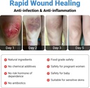 lmnoop-wound-healing-ointment-for-chroni-6.jpg