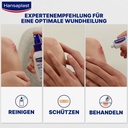hansaplast-sensitive-plaster-1-m-x-6-cm--61q6dRmZbpL.jpg