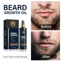 beard-oil-for-men-5-beard-growth-oil-for-5.jpg
