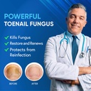 4pcs-toenail-fungus-treatment-25-undecyl-2.jpg