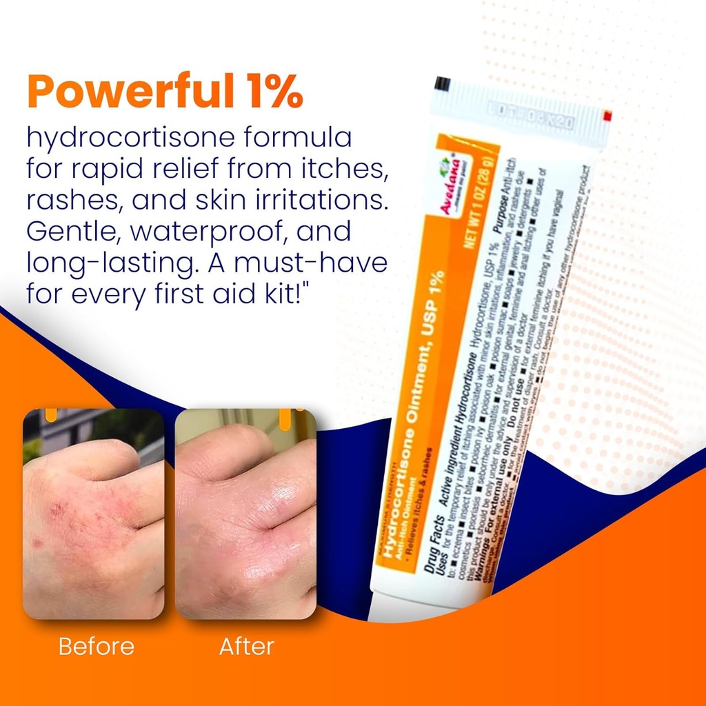 hydrocortisone-ointment-1oz-hydrocortiso-2.jpg