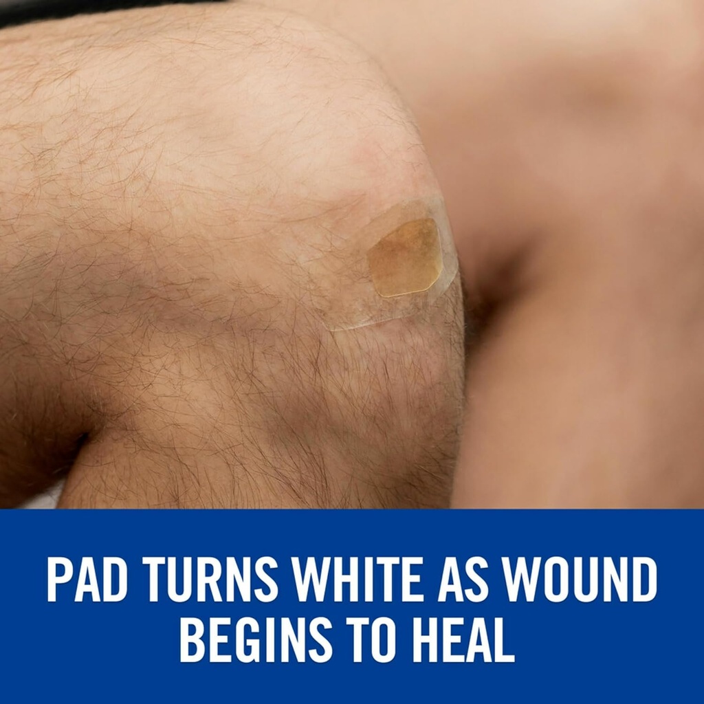nexcare-advanced-healing-waterproof-band-3.jpg