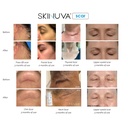 skinuva-next-generation-scar-cream---adv-6.jpg