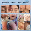 baby-eczema-cream-for-dry-itchy-skin-soo-6.jpg