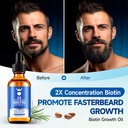 beard-growth-oil---2x-concentration-biot-2.jpg