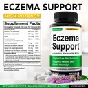 greenford-eczema-treatment-support-for-n-2.jpg