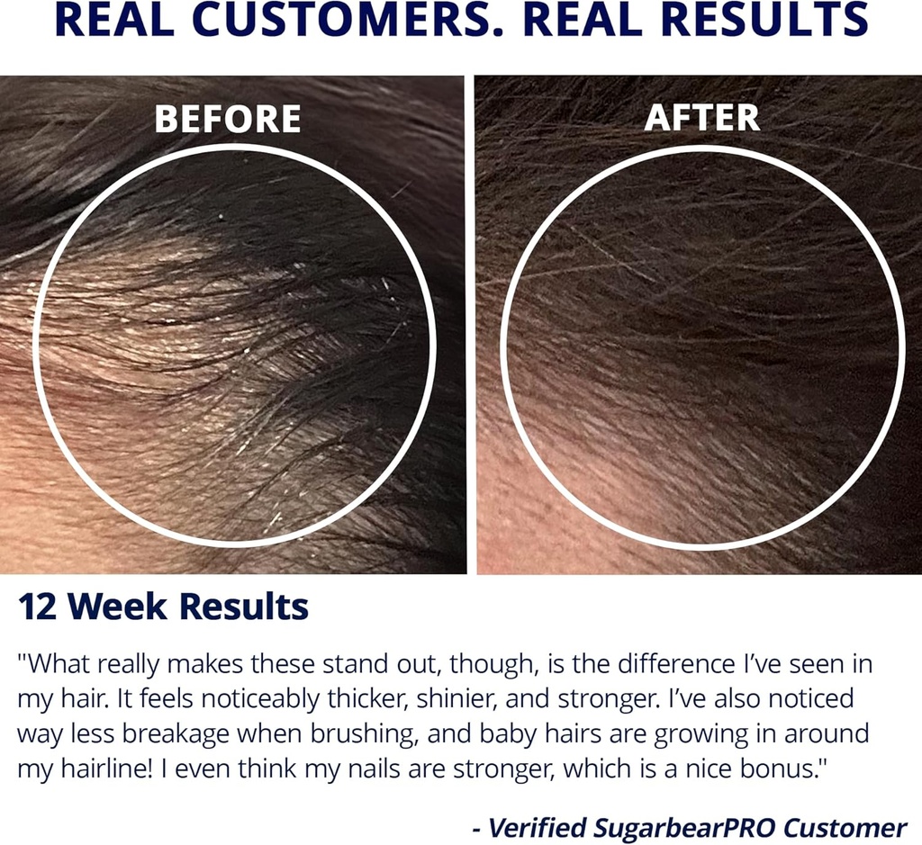 sugarbearpro-hair-vitamin-gummy-14-day-s-5.jpg