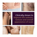 mederma-advanced-scar-gel---treats-old-n-5.jpg
