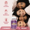 mommyz-love-biotin-gummies-5000mcg-for-h-3.jpg