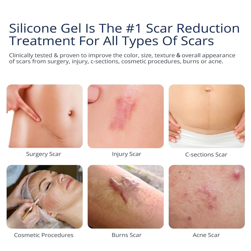 100-silicone-scar-gel-scar-cream---advan-2.jpg