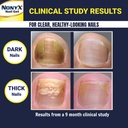 nonyx-fungal-nail-clarifying-gel-clinica-4.jpg