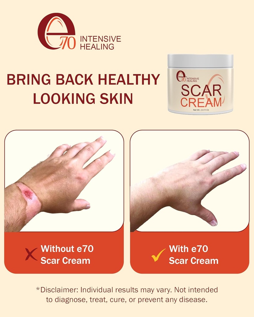 scar-cream-gel-for-surgical-scars-fast-r-5.jpg