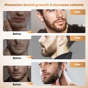 beard-oil---natural-care-facial-beard-oi-3.jpg