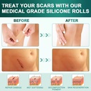 silicone-scar-sheets-silicone-scar-tape--2.jpg