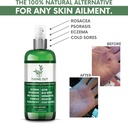 all-natural-eczema-treatment--psoriasis--2.jpg