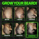 beard-growth-kit-wgrow-beard-oil-for-men-3.jpg