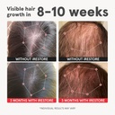 irestore-advanced-hair-growth-supplement-2.jpg