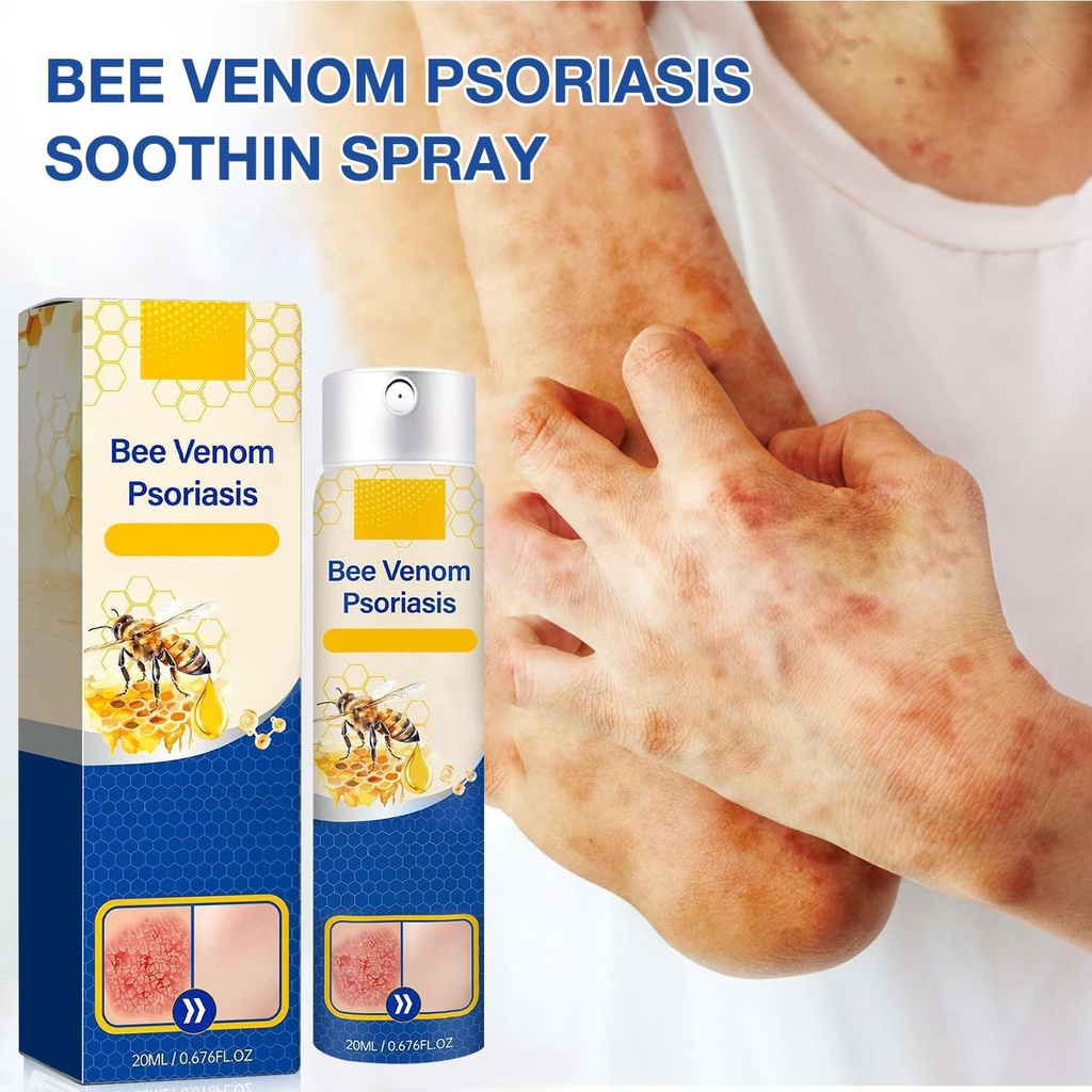 2-pcs-psoriaheal-bee-venom-psoriasis-tre-4.jpg