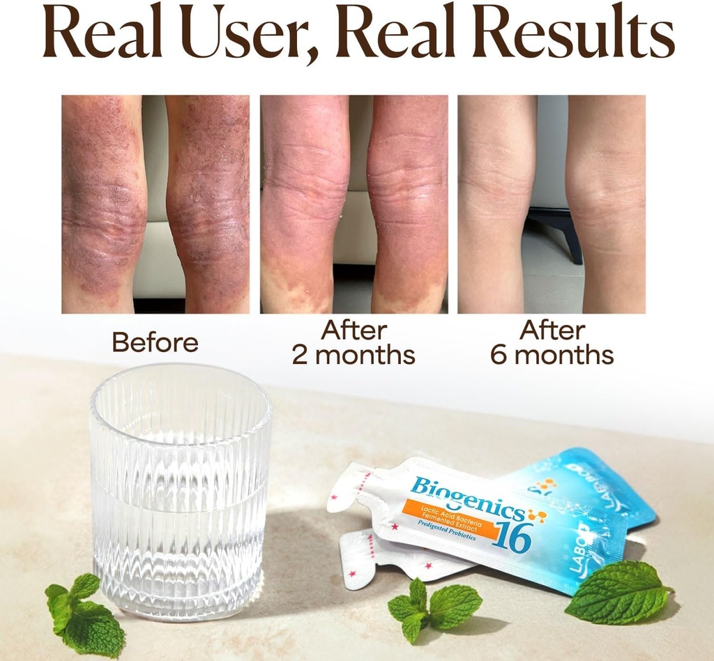 LABO Nutrition Biogenics 16–Lactic Acid Bacteria Fermented Extract, 1000x More Effective, Gut Health Support Beyond Probiotics & Prebiotics, Improve Intestinal Skin and Immune Health, 10mlx15 sachets 6