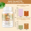 Saw Palmetto for Women Hair Loss - DHT Blocker with 5-in-1 Blend for Hair Growth, Skin & Nails, Urinary Wellness - Extra Strength Saw Palmetto Supplement - 180 Capsules 4