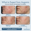 hormonal-acne-treatment-for-women-no-dim-2.jpg