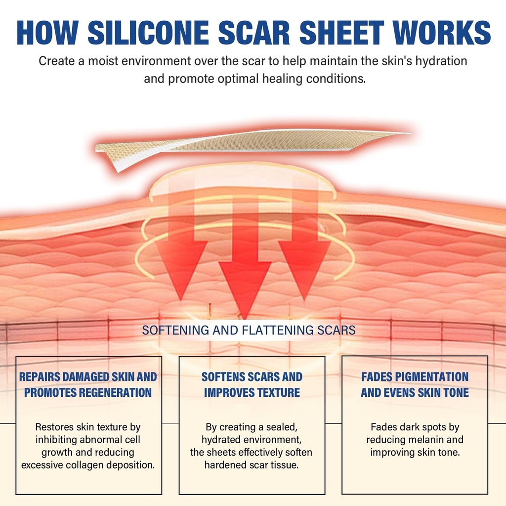 silicone-scar-sheets-silicone-scar-tape--4.jpg