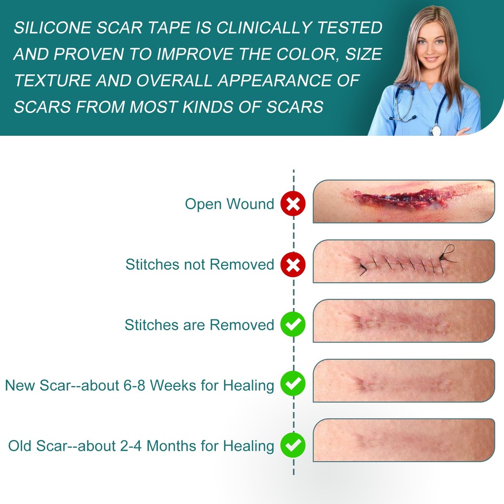 silicone-scar-sheets-1-6-x-158-roll-4m-s-6.jpg