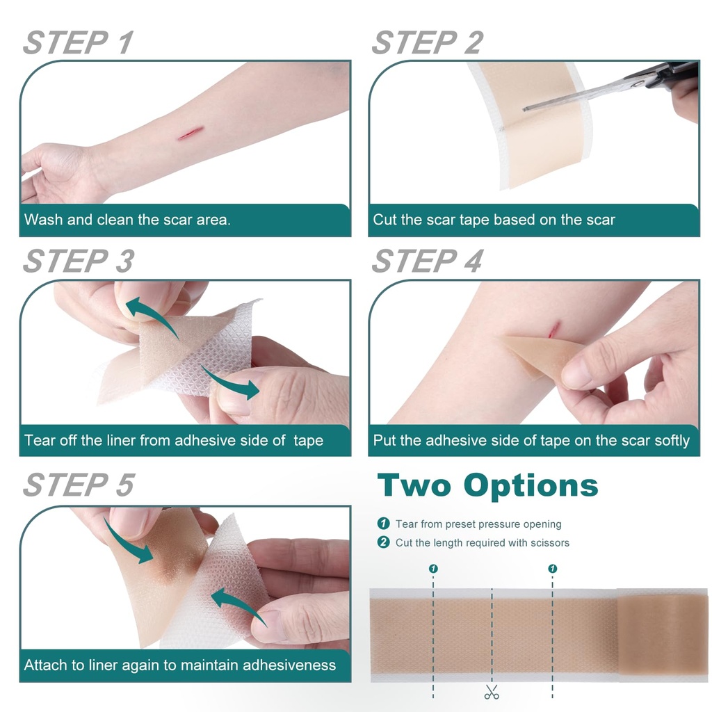 silicone-scar-sheets-1-6-x-158-roll-4m-s-5.jpg