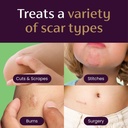 mederma-scar-gel-for-kids-reduces-appear-6.jpg