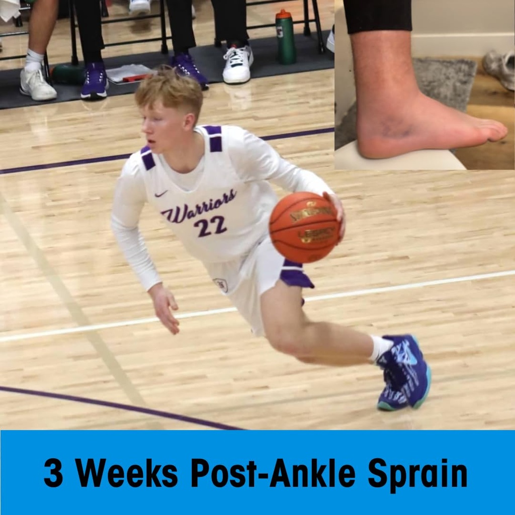 ankle-sprain-recovery-patches-helps-spee-5.jpg