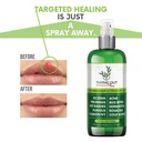 thyme-out-plus-eczema-treatment-psoriasi-6.jpg