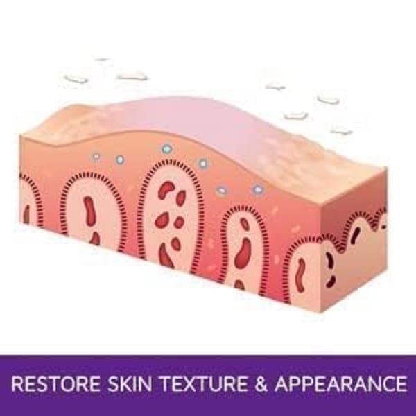 prosoria-psoriasis-exfoliating-moisturiz-4.jpg