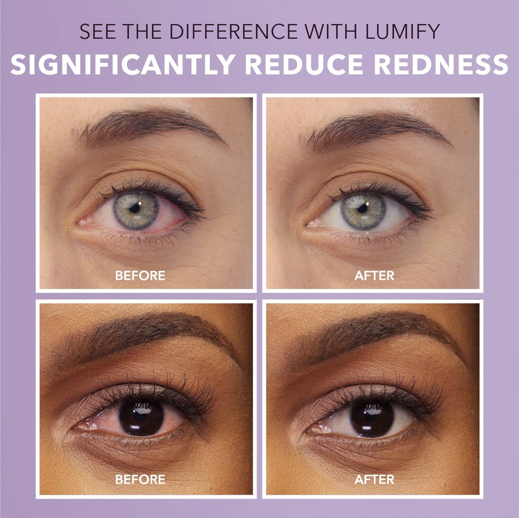 lumify-eye-drops-for-red-eyes-redness-re-2.jpg