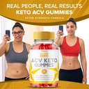 all-star-keto-acv-gummies-allstar-keto-g-2.jpg