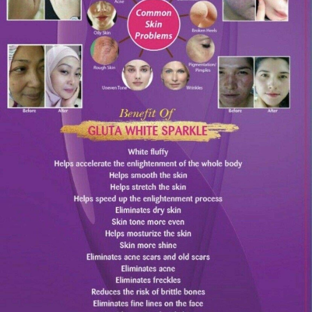gluta-white-sparkle-l-glutathione-plus-b-3.jpg