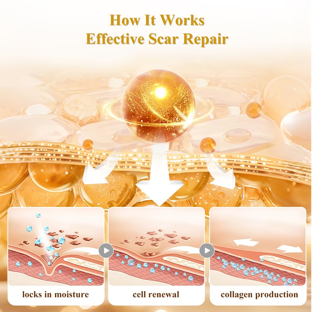 scar-cream-silicone-scar-gel-scar-cream--5.jpg
