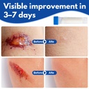 poxo-collagen-powder-for-wounds-100-bovi-2.jpg