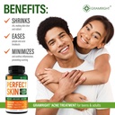 perfect-skin-acne-pills-clear-skin-suppl-5.jpg