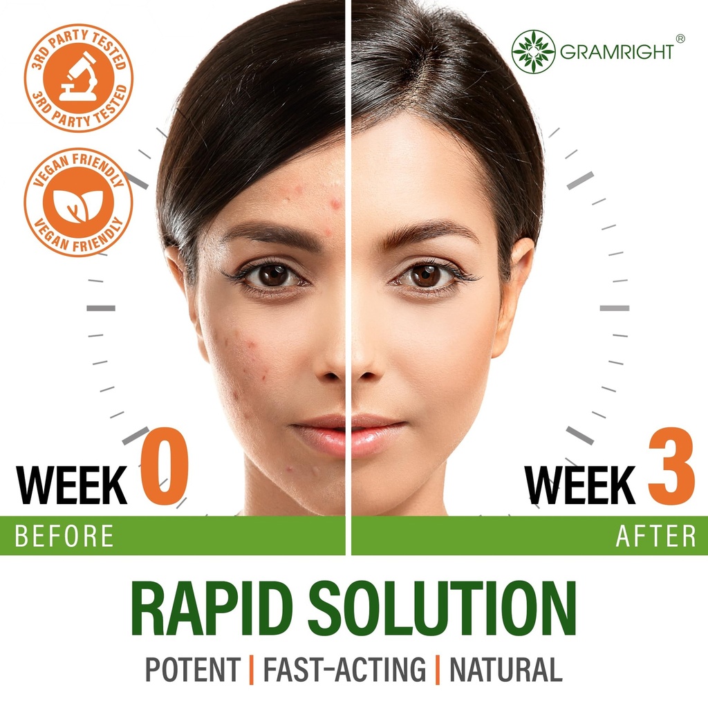 perfect-skin-acne-pills-clear-skin-suppl-3.jpg