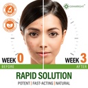 perfect-skin-acne-pills-clear-skin-suppl-3.jpg