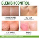 perfect-skin-acne-pills-clear-skin-suppl-4.jpg