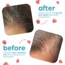 artnaturals-biotin-gummies-for-hair-grow-5.jpg