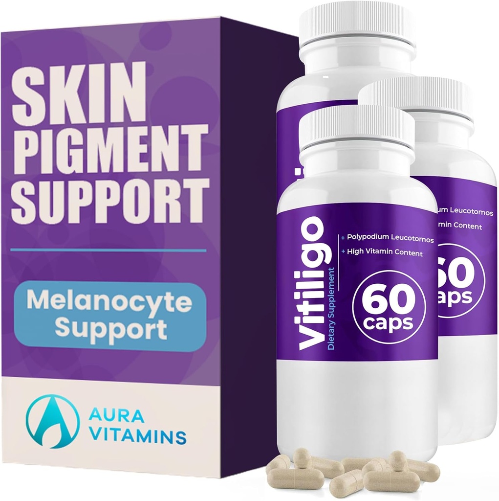 Vitiligo Capsules 60 Kont | 1 Ay | Skin Pigmentation Support geliştirmek ve Beyaz Spotları Azaltmak | Etkili Vitiligo Supplement | Beyaz Spotlar için Doğal Çözüm (3)