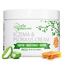 Wild Naturals Eczema & Psoriasis Cream Kuru, Itchy Skin - Yetişkinler ve Çocuklar için Eczema Yardımı - Manuka Honey ile Psoriasis Kremi - Eller ve Faceting Honey Lotion for Hands and Face