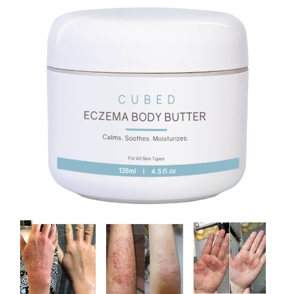 Cubed 4.5 oz Eczema Kremi Yetişkinler, Eczema Relief, Eczema Tedavisi, Moisturize Kuru Irridated Skin, Smart Lotion for Topical Steroid Withdrawal Belirtileri, Psoriasis & Rosacea, Eczema, Dermatitis
